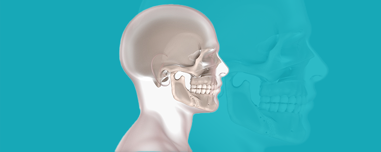 cirurgia ortognática
